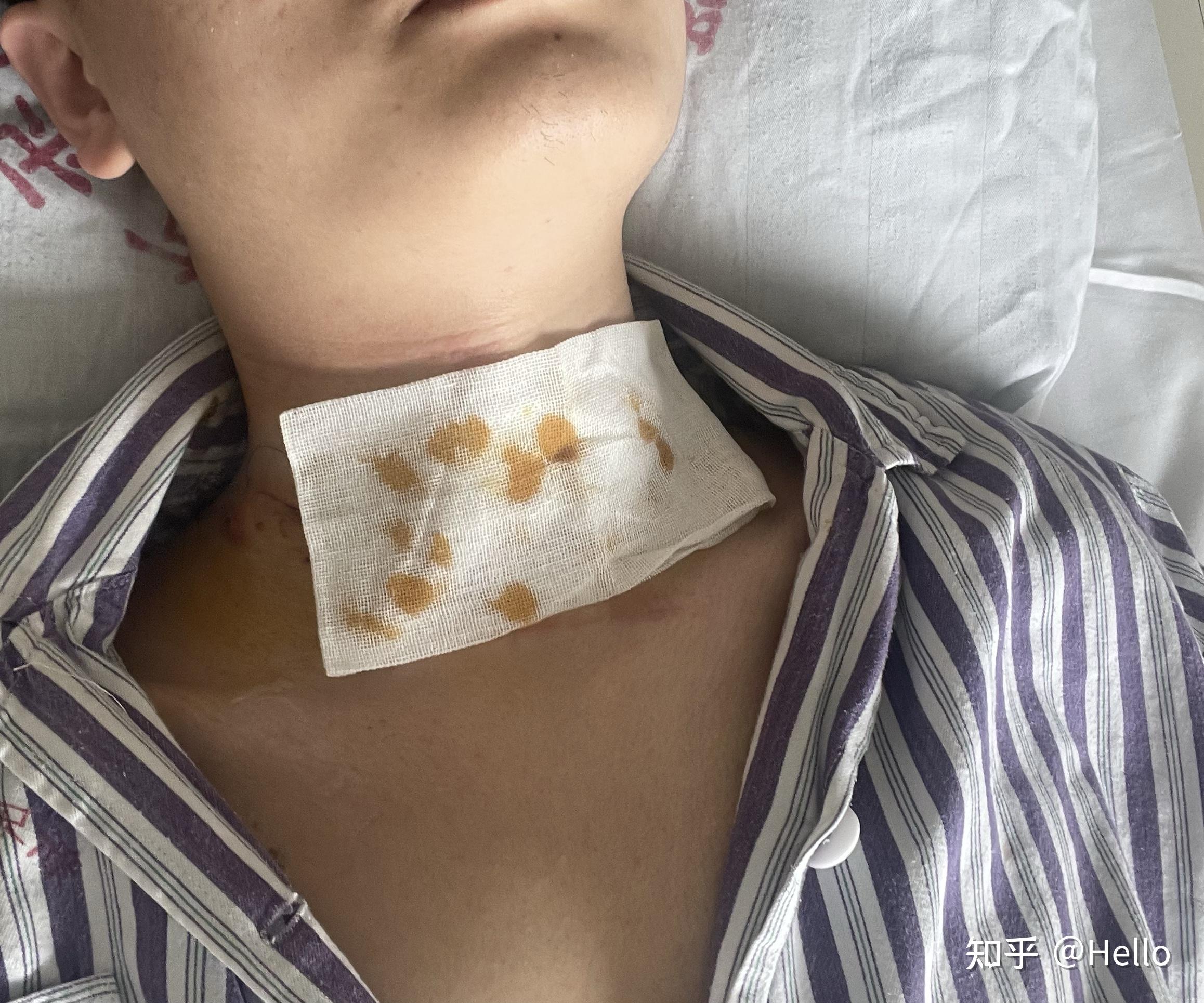 关于131检查的全过程解析,全面解析131检查过程,步骤、细节及应用